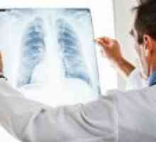 Plicní absces: příčiny, příznaky, léčba