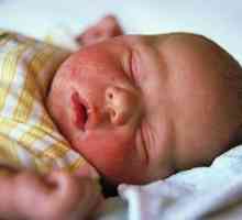 Atopické dermatitidy u kojenců: bezpečné a účinné léčby