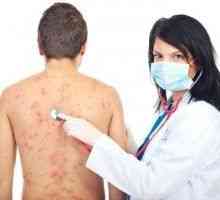 Alergický na kůži, alergická kožní vyrážka