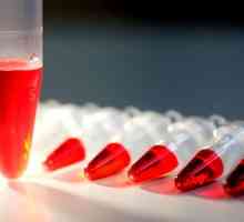 Krevní testy na hormony štítné žlázy