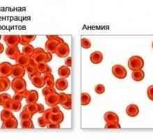 Anémie krve, což má za následek chudokrevnost, krve?