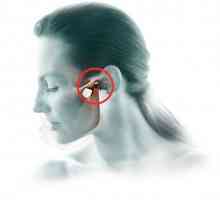 Artritida maxilofaciálních společné příznaky a léčba