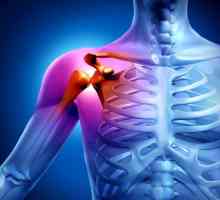 Artritida ramenního kloubu: příznaky a léčba