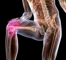 Onemocnění kolenního kloubu Koenig