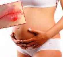 Herpes během těhotenství - ať už je to nebezpečné?