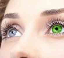 Heterochromia očí: příčiny, příznaky, léčba