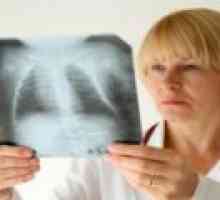 Chronický zánět plic: Příznaky, léčba