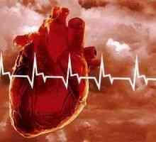 Srdeční infarkt, způsobí srdeční infarkt