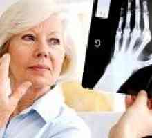 Postižení u revmatoidní artritidy: Příčiny