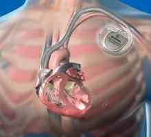 Kardiostimulátor: Jaké jsou kontraindikace po instalaci