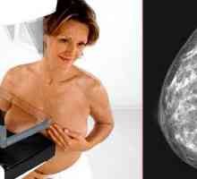 Mamografie prsu