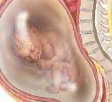 Polyhydramnios během těhotenství, příčiny, následky