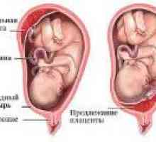 Low placentace během těhotenství, co to je?