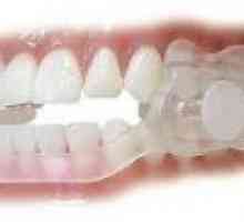 Noční skřípění zubů - příčiny, léčba