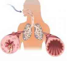 Obstrukce dýchacích cest