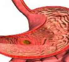 Ohnisková atrofická gastritida: příčiny, příznaky, léčba