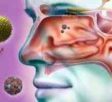 Odontogenní čelistní sinusitida, příznaky, léčba