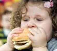 Obezita u dětí - příznaky, léčba, recenze