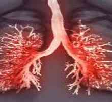 Zánět pohrudnice plíce - příznaky a ošetření zánět pohrudnice
