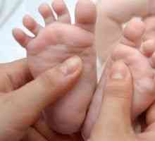 Ploché nohy u dětí příčiny, léčba