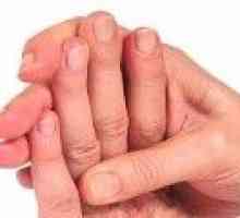 Proč necitlivé prsty levé ruky, důvody