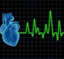 Pomoc při kardiogenním šoku