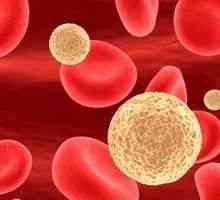 Nízký počet krevních leukocytů: Příčiny a léčba