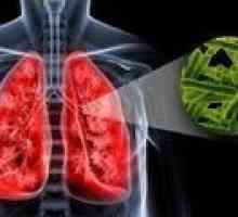 Příčiny plicní tuberkulózy