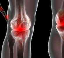 Reaktivní artritida: příznaky a léčba