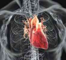 Srdce revmatismus