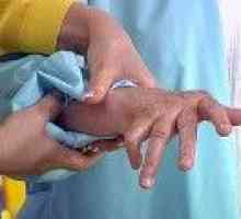 Revmatoidní artritida: Léčba současných a tradičních metod
