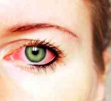 Metody čištění spojivek oka