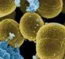 Tamoxifen může bojovat is Staphylococcus aureus