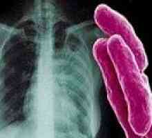 Původcem tuberkulózy. Jak je TB?