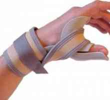 Vykloubení palce - příčiny, příznaky a léčba