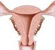 Glandulární hyperplazie endometria - příčiny, léčba