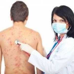 Alergický na kůži, alergická kožní vyrážka