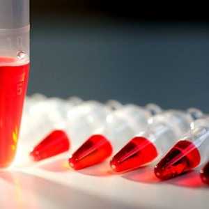 Krevní testy na hormony štítné žlázy