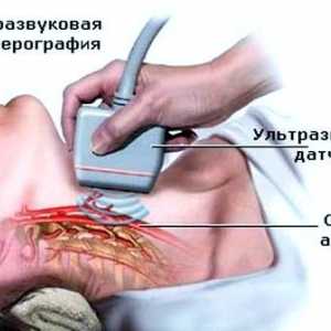 Doppler ultrazvuk (sonografie) výzkumná plavidla mozku a krku
