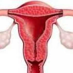 Hyperplazie endometria po kyretáž