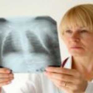 Chronický zánět plic: Příznaky, léčba