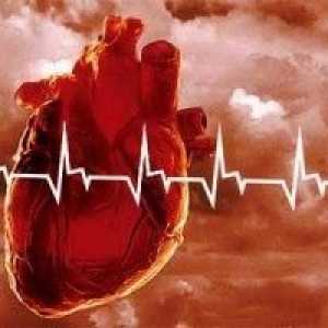 Srdeční infarkt, způsobí srdeční infarkt