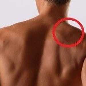 Což je důvod, proč bolest ramene?
