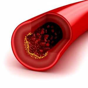 Jak rychle snížit cholesterol lidových opravné