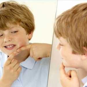Jak se zbavit akné na obličeji teenager