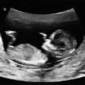 Jak dešifrovat ultrazvuku v průběhu těhotenství?