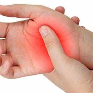 Léčba artritidy v domácí lidových prostředků