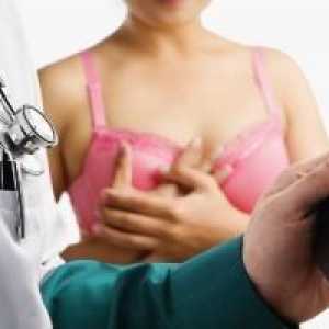 Amputace prsu - operace za účelem odstranění prsu