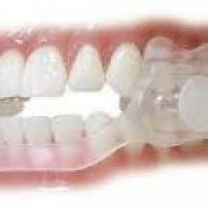 Noční skřípění zubů - příčiny, léčba