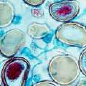 Perfuzní - způsob dodávky biologické tkáně